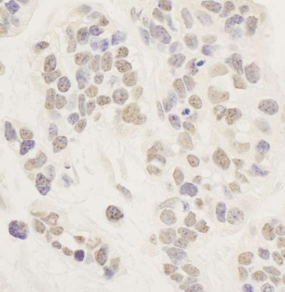 AFF1 / AF4 Antibody (aa1-50)