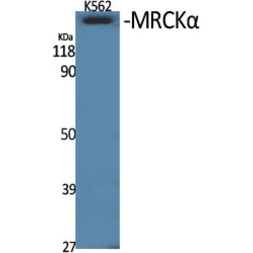 CDC42BPA / MRCK Antibody (Internal)