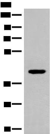 Polyclonal Rabbit anti-Human FCGRT / FCRN Antibody (IHC, WB)