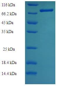Human TXNRD2 Protein (Recombinant His-SUMO)