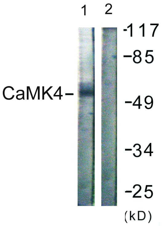 IHC-plus™ Polyclonal Rabbit anti-Human CAMK4 / CaMK IV Antibody (aa166-215, IHC, IF, WB)