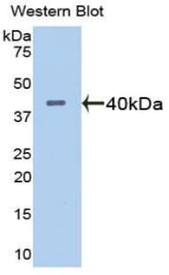 ADAMTS1 Antibody (aa560-911)