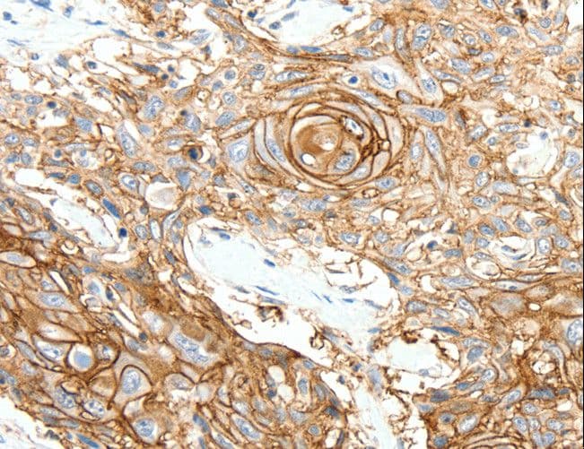 IHC-plus™ Polyclonal Rabbit anti-Human SCN10A / Nav1.8 Antibody (aa31-45, IHC)