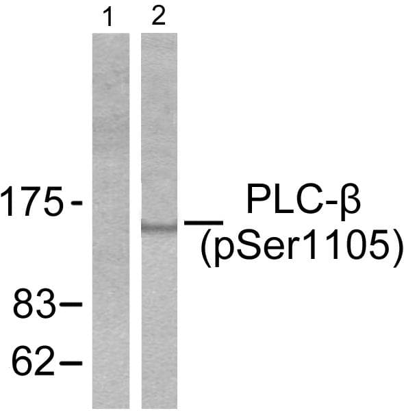 PLCB3 Antibody (phospho-Ser1105)