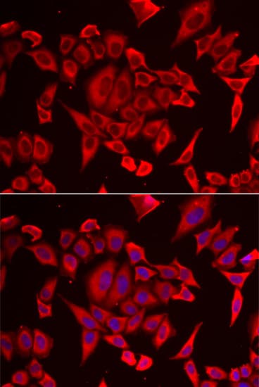 SLC20A2 / PIT2 Antibody
