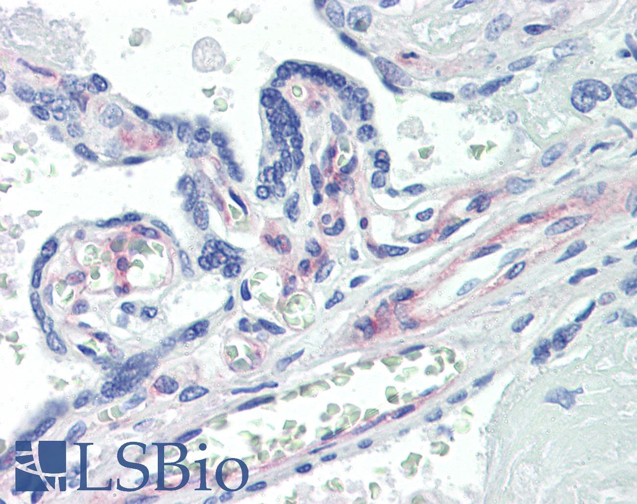 IHC-plus™ Monoclonal Mouse anti-Human PDGFRB / PDGFR Beta Antibody (clone 42G12, IHC, WB)