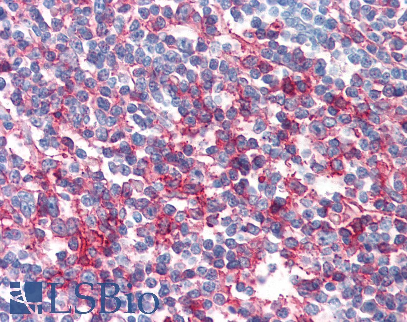 IHC-plus™ CD95 / FAS Antibody (clone LT95)
