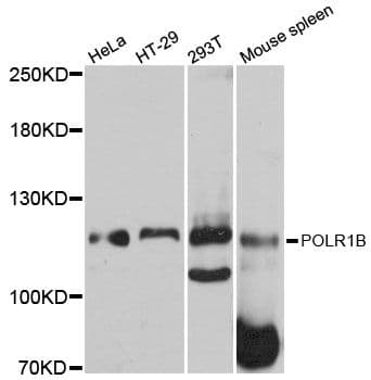 Polyclonal Rabbit anti-Human POLR1B Antibody (WB)