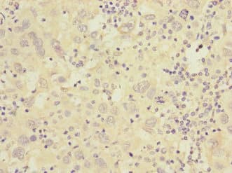 CACNG7 Antibody