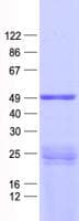 Human PPP1R36 / C14orf50 Protein (Recombinant His, N-Terminal)