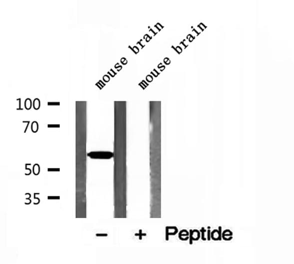 CCT3 Antibody