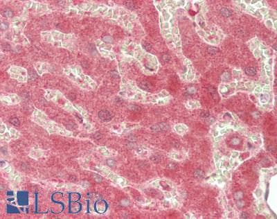 IHC-plus™ CYP39A1 Antibody (aa336-385)