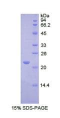 Human REXO2 Protein (Recombinant His)