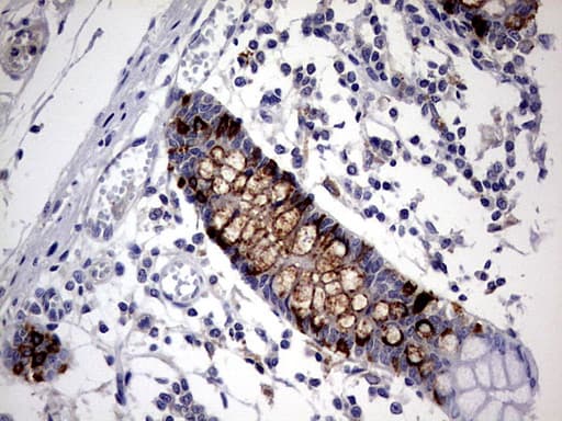 CD30 Antibody (aa19-379, clone OTI3A2)