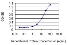 GFAP Antibody (clone 8H3)