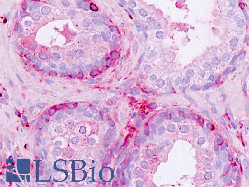 IHC-plus™ NPDC1 Antibody (aa189-238)