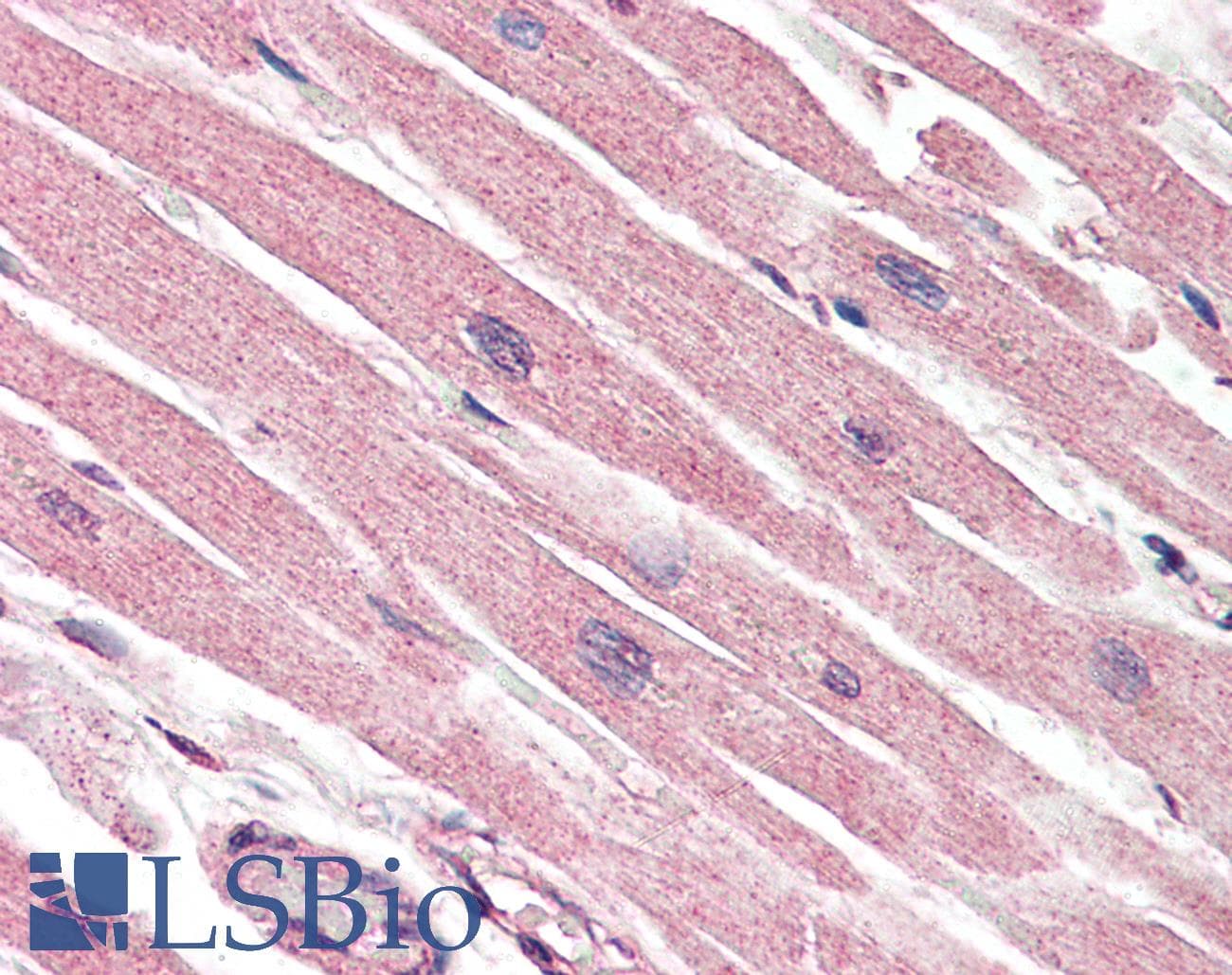 IHC-plus™ CASP1 / Caspase 1 Antibody