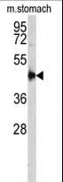 CTSE / Cathepsin E Antibody (aa157-187)