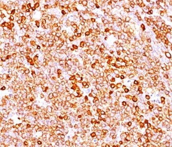 CD79A / CD79 Alpha Antibody (aa202-216, clone JCB117 + HM47/A9, Ready-to-Use)