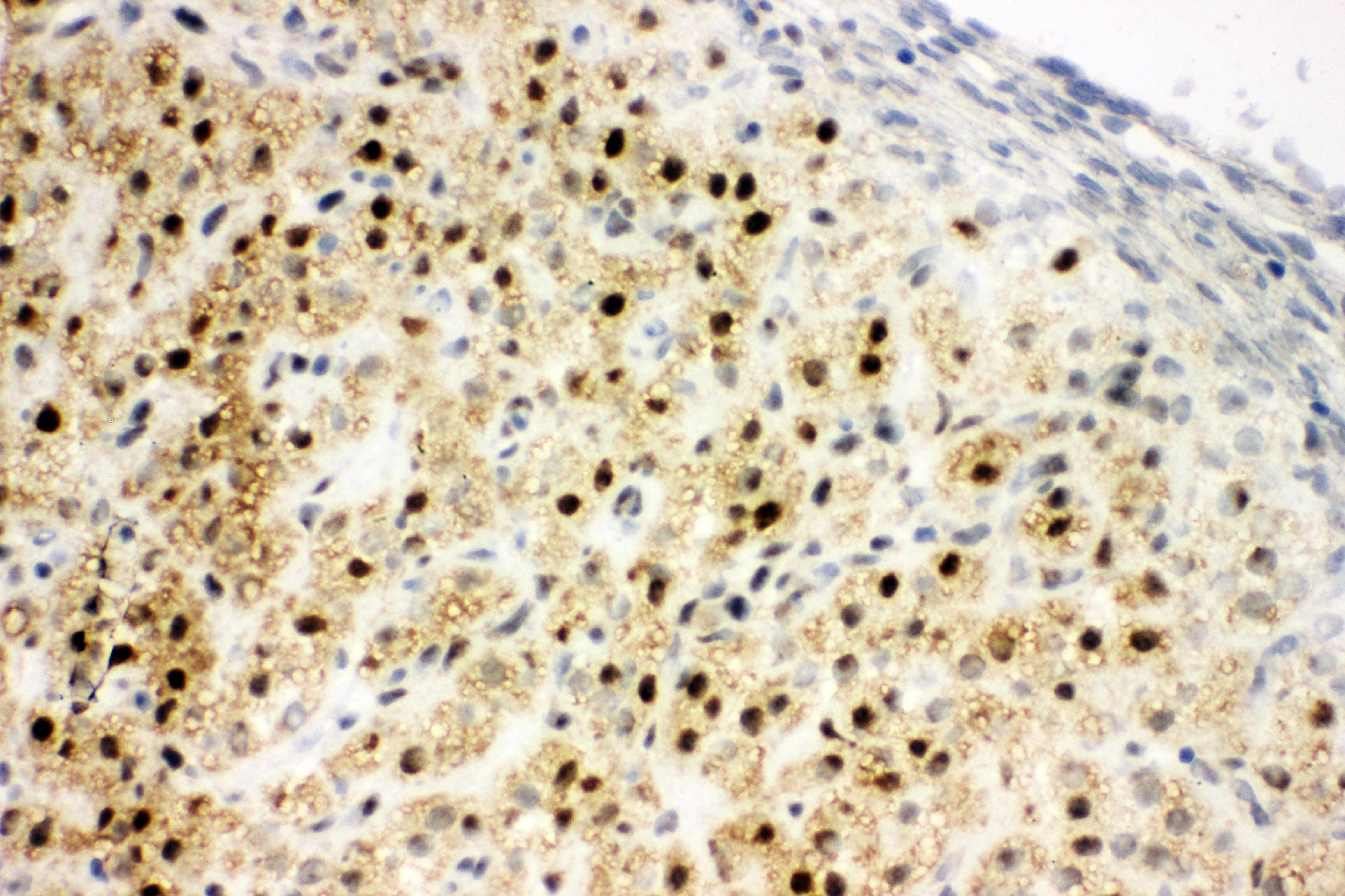 Polyclonal Rabbit anti-Human MTA1 Antibody (aa676-696, IHC, WB)