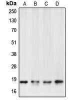 CASP6 / Caspase 6 Antibody (Internal)