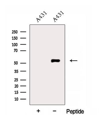 ERO1A / ERO1L Antibody
