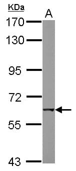 CHRNB1 Antibody