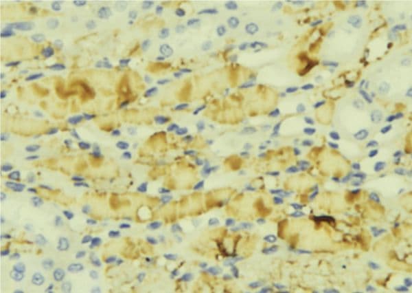 MTTP / MTP Antibody