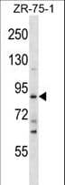 SLITRK4 Antibody (aa748-777)