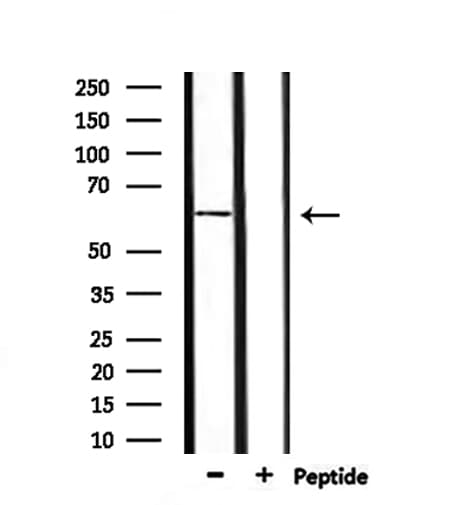 IFNAR1 / IFNAR Antibody