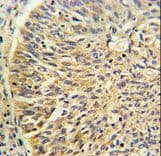 CCT3 Antibody (aa298-326)