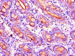 DYNC2H1 Antibody