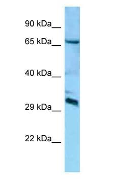 DCUN1D4 Antibody (aa201-250)