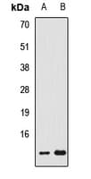 FDX1 / ADX Antibody