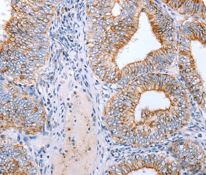 CLDN3 / Claudin 3 Antibody