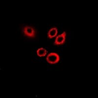 Polyclonal Rabbit anti-Human SERPINB1 Antibody (IF, WB)