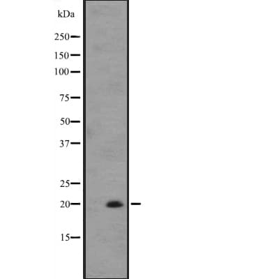 IL25 / IL17E Antibody