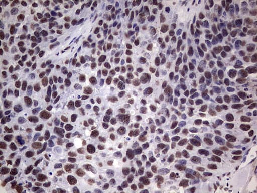 MYF5 / MYF 5 Antibody (clone OTI2G5)