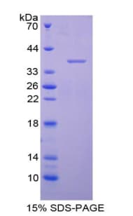 Human AQP1 / Aquaporin 1 Protein (Recombinant His-GST)