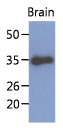 Monoclonal Mouse anti-Human KLF7 Antibody (clone AT3G3, IHC, WB)