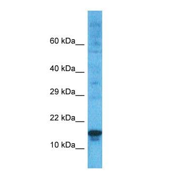 PRDM5 Antibody (aa21-70)
