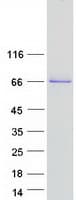 Human COL23A1 / Collagen XXIII Protein (Recombinant Myc-DDK (Flag))