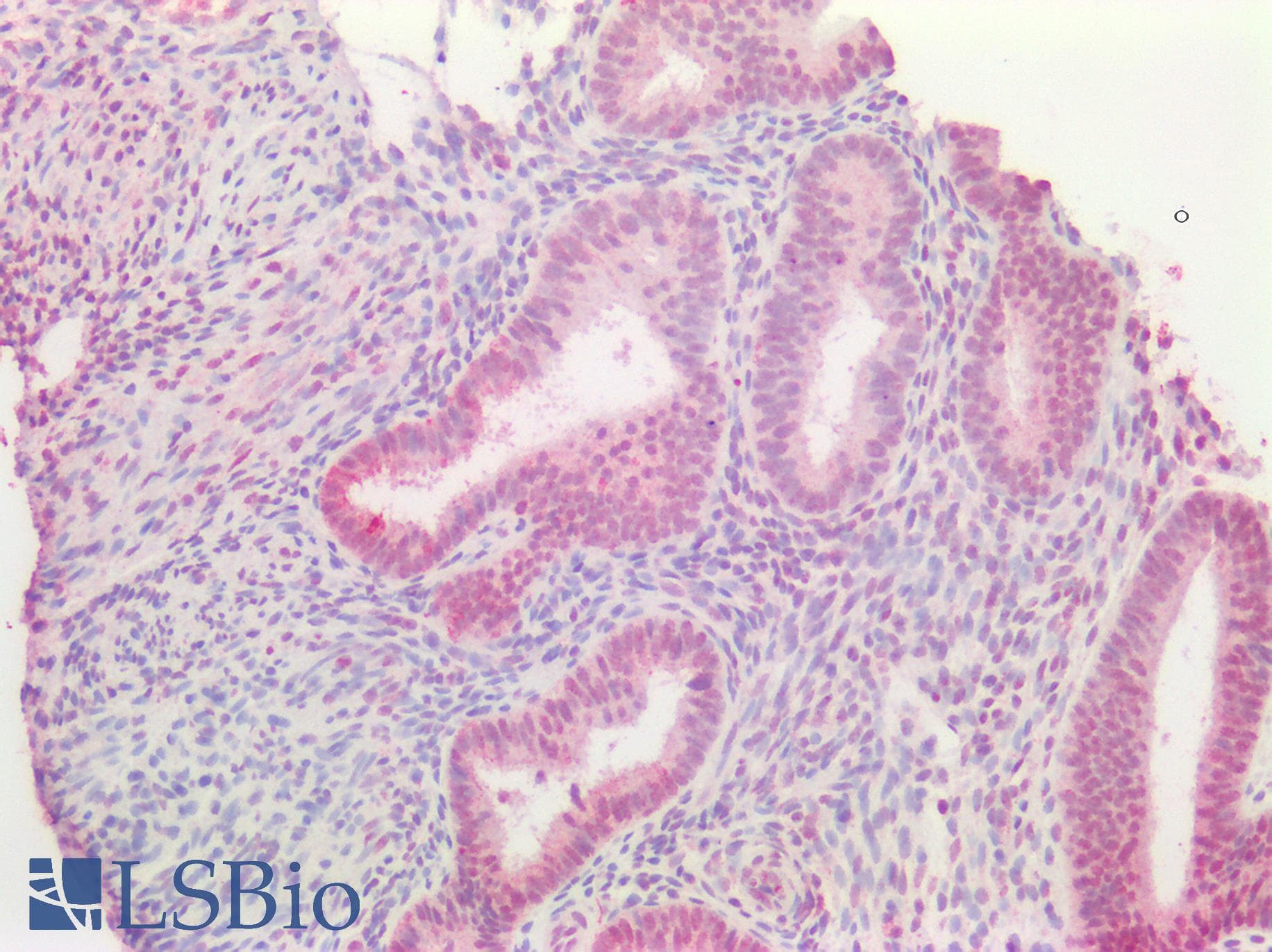 PathPlus™ Requiem / DPF2 Antibody