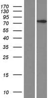 CCDC142 Protein (Over-Expression Lysate Myc-DDK (Flag))