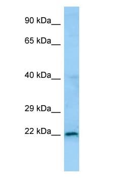 NXNL1 / TXNL6 Antibody (aa61-110)
