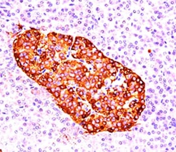 CHGA / Chromogranin A Antibody (clone CGA414, Ready-to-Use)