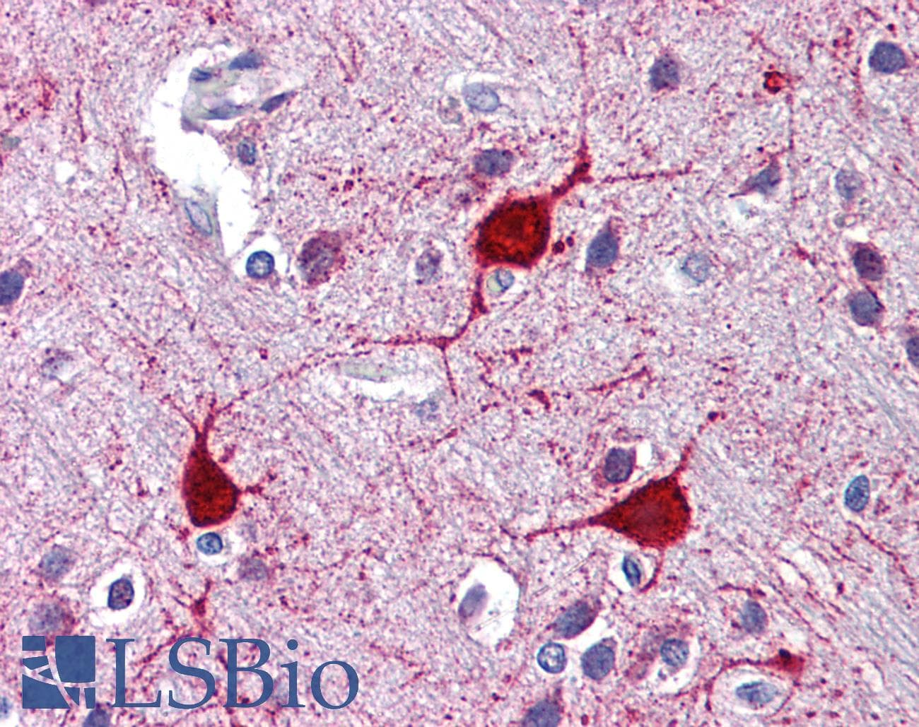 Polyclonal Rabbit anti-Human LYVE1 Antibody (N-Terminus, IHC, WB)