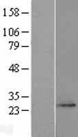 FAM168A Protein (Over-Expression Lysate Myc-DDK (Flag))