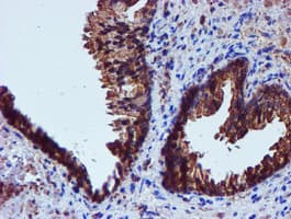 IDS / Iduronate 2 Sulfatase Antibody (clone OTI4G2)