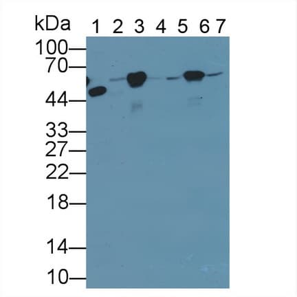 TUBB / Beta Tubulin Antibody (aa170-419)